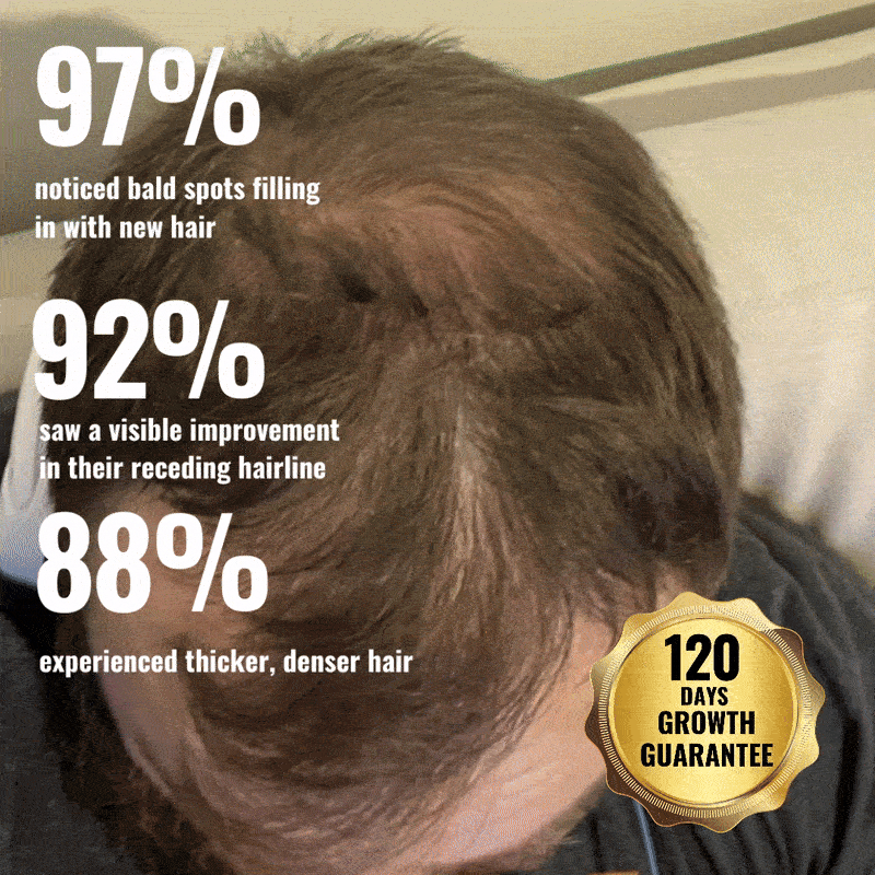97 Prozent berichten von neuem Haarwuchs, 92 Prozent von sichtbarer Verbesserung, 88 Prozent von dichterem Haar – 120 Tage Wachstumsgarantie